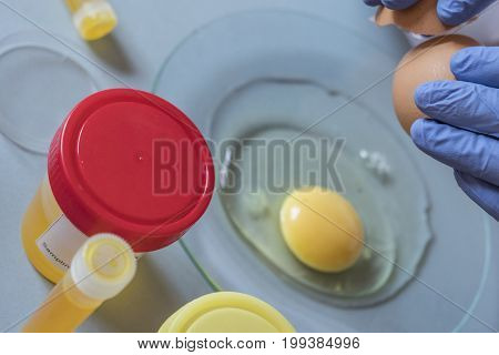 Scientist at laboratory investigates the crisis caused by the fraud of the contaminated eggs with fipronil in Spain
