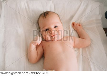 A Baby With Seborrheic Dermatitis On His Head Rests On A White Sheet. Childcare.