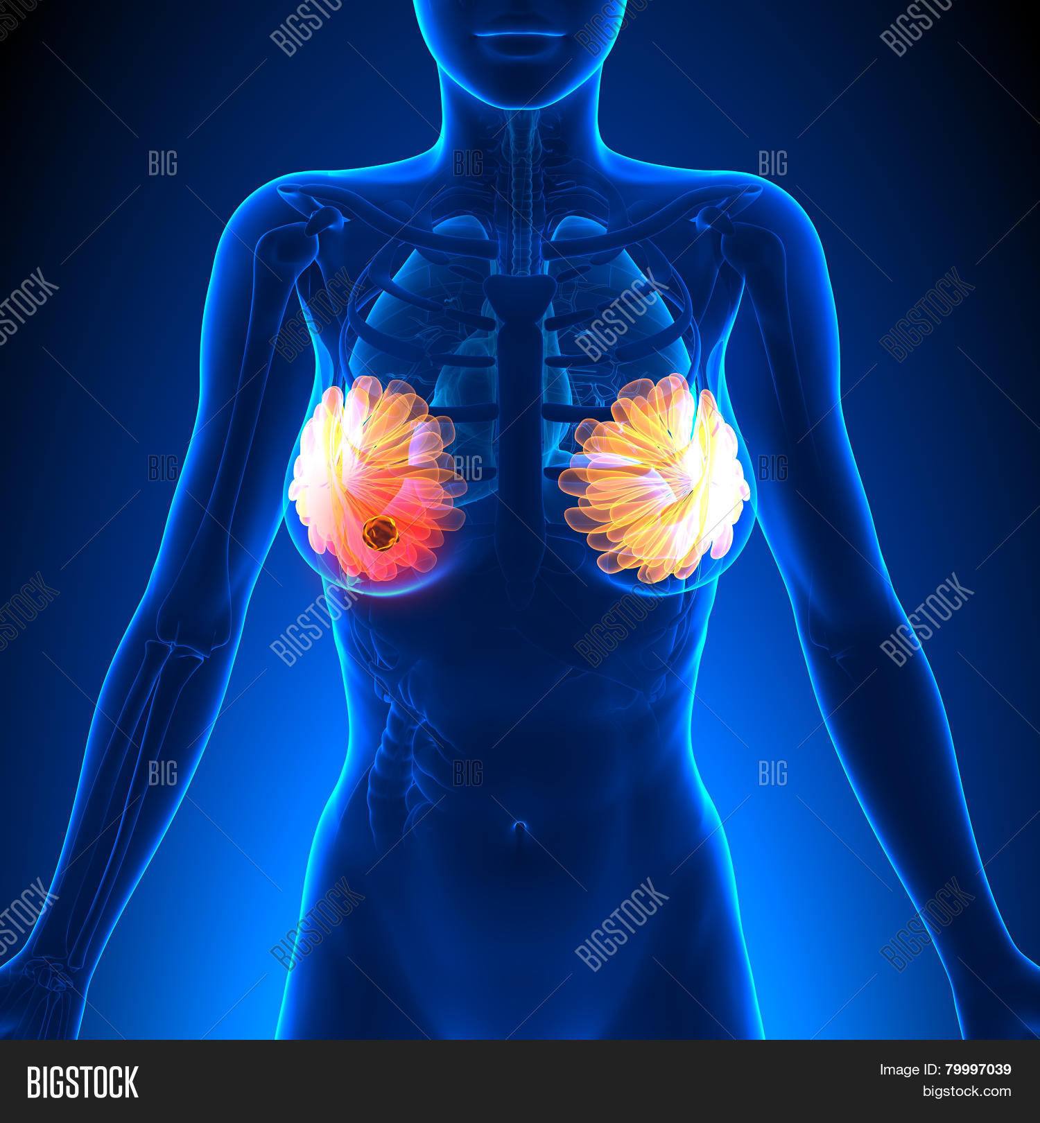 Breast Cancer Female Image Photo Free Trial Bigstock