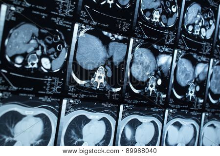 research in medicine. CT scan of the patient.