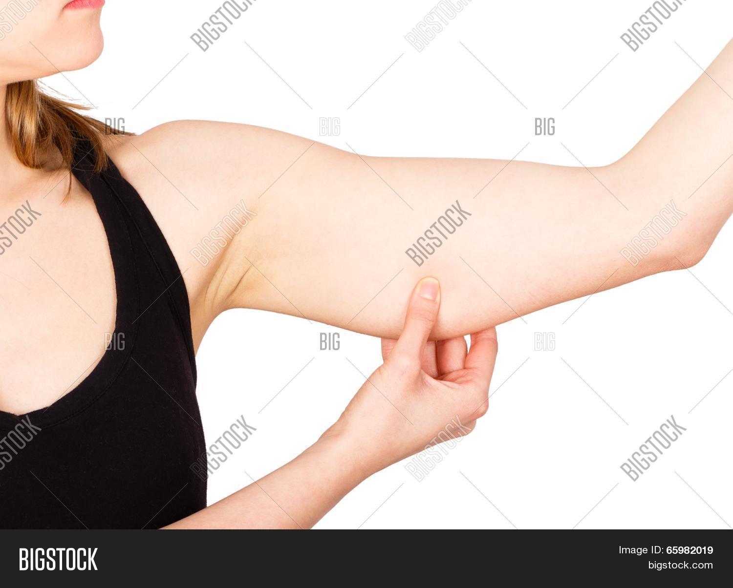 woman showing loose upper arm thanks to unhealthy lifestyle.